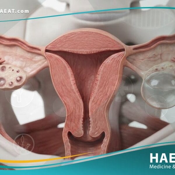 اكياس على المبايض