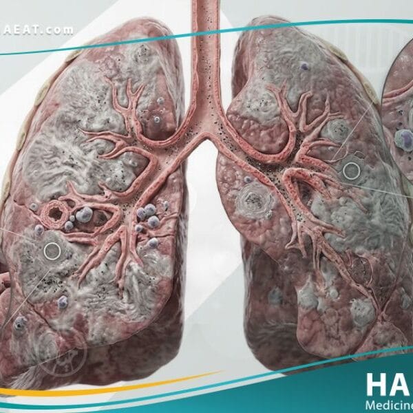 الأمراض المهنية