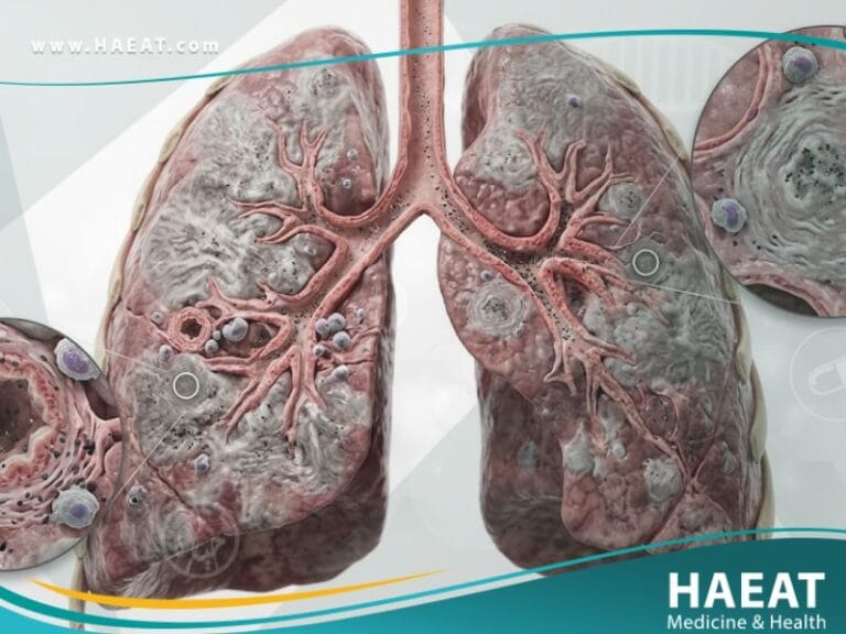 الأمراض المهنية