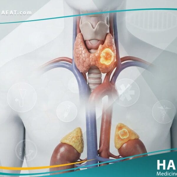 الأورام الصماوية