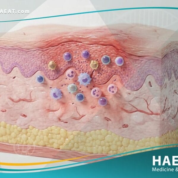 _التهاب الجلد