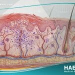 التهاب الجلد التماسي