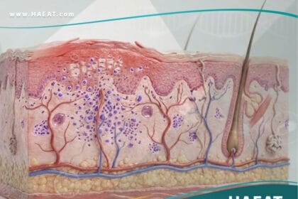 التهاب الجلد التماسي