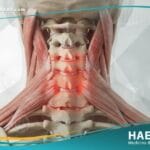 التهاب العنق (1)