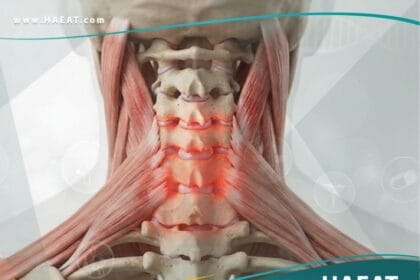 التهاب العنق (1)