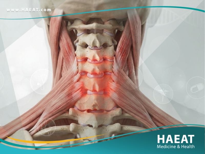 التهاب العنق (1)