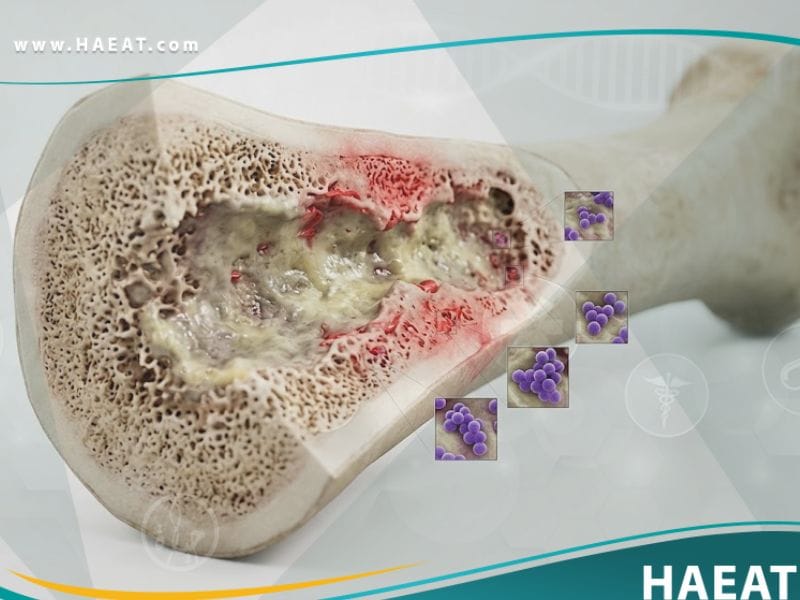 التهاب جهاز الهيكل العظمي