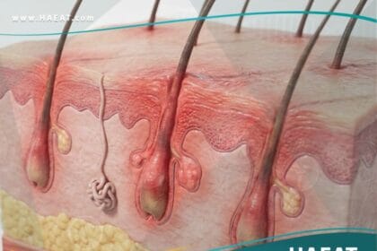 التهابات العانة