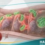 التيفوس المتوطن