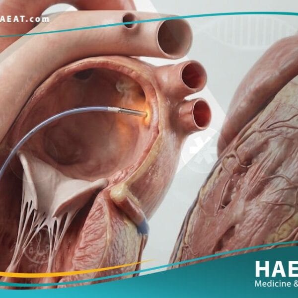 _الجذ القثطاري