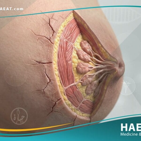 الحلمات المتصدعة