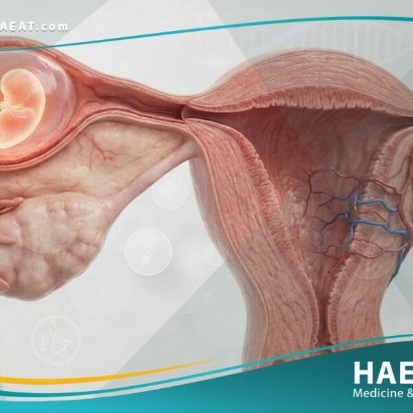 الحمل المنتبذ