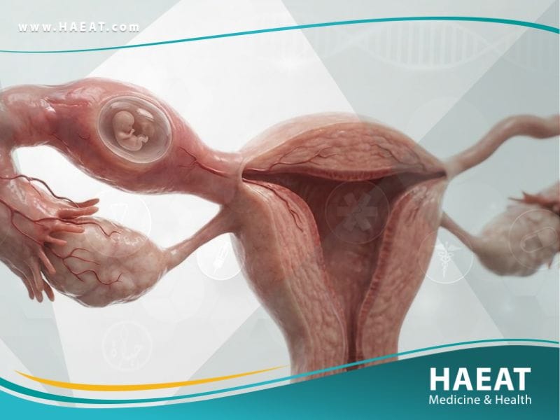 الحمل خارج الرحم