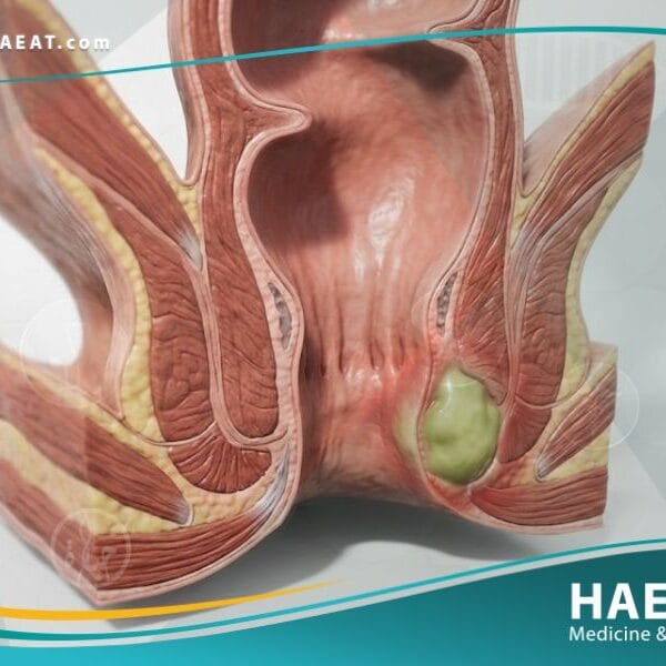 الخراج الشرجي