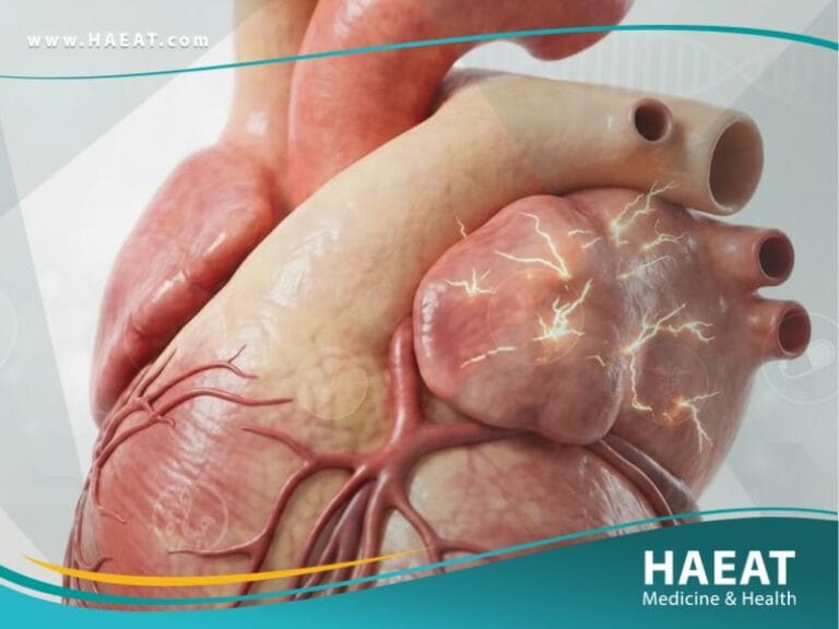 الرجفان الأذيني