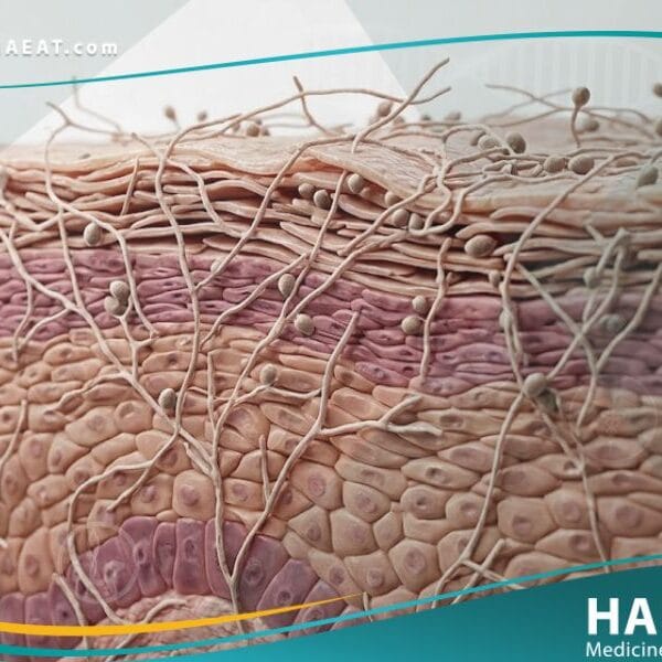 _السعفة الإربية