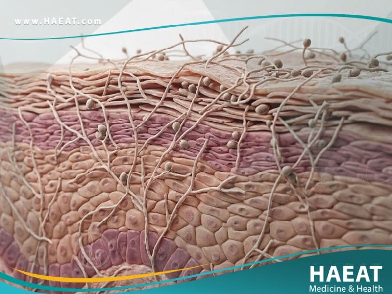 _السعفة الإربية