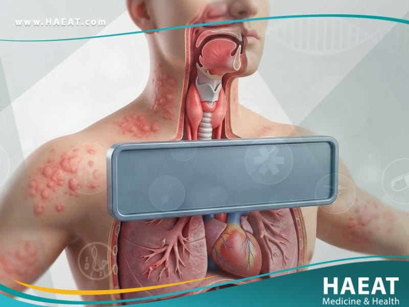 _الصدمة التأقية