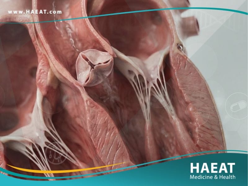 الصمام الابهري