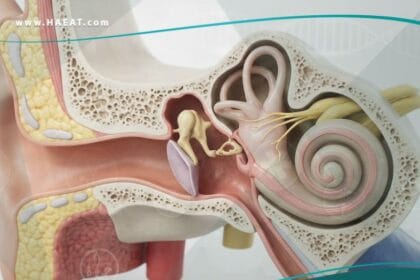 الصمم الخلقي في الأذن الداخلية