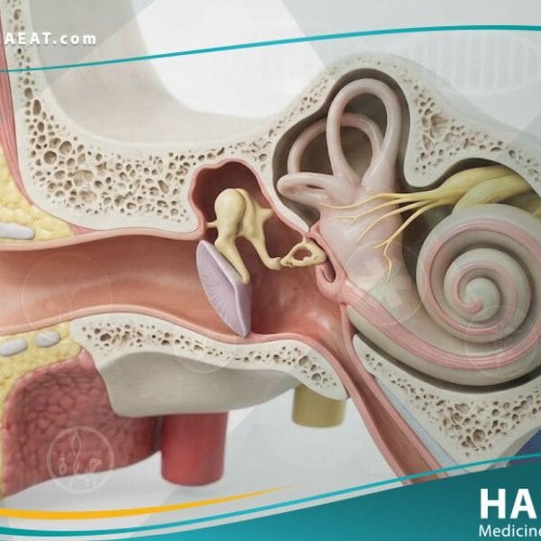 الصمم الخلقي في الأذن الداخلية