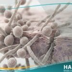 العدوى بداء المبيضات