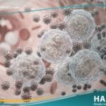 العوز المناعي الثانوي