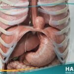 الفتق الحجابي