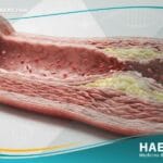 _القصور البطاني