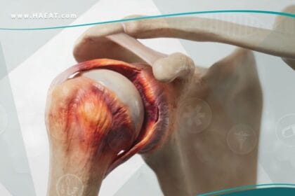 الكتف المتجمدة