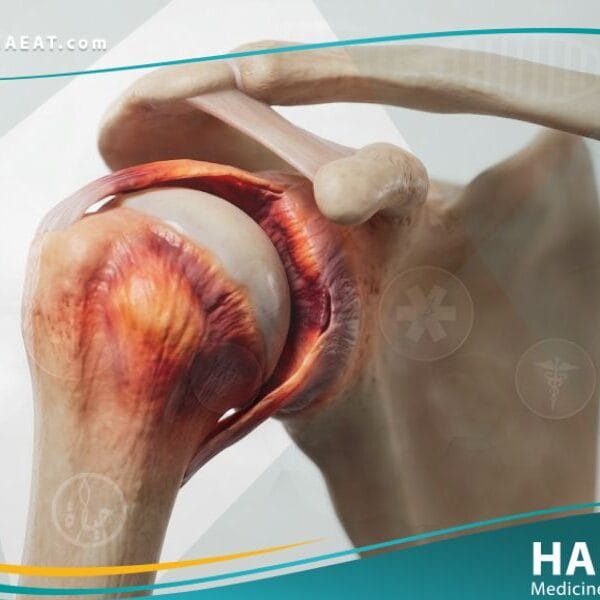 الكتف المتجمدة