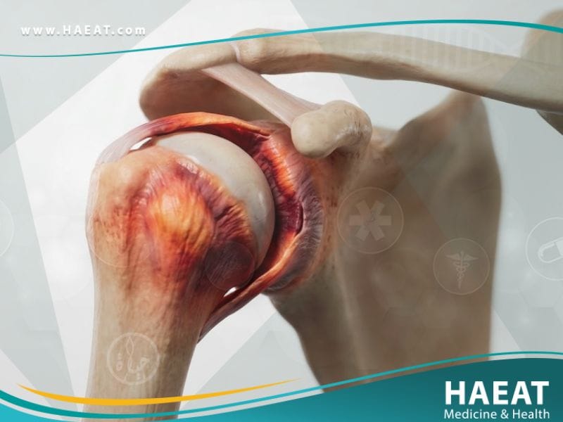 الكتف المتجمدة