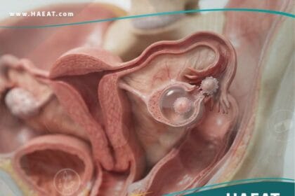 الم التبويض