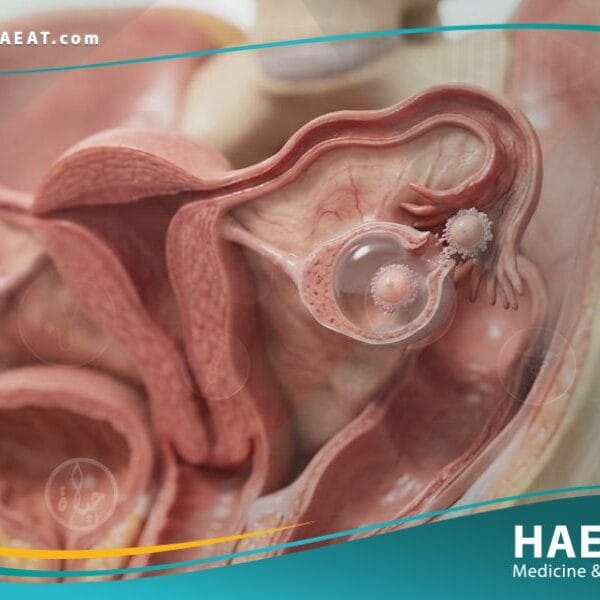 الم التبويض