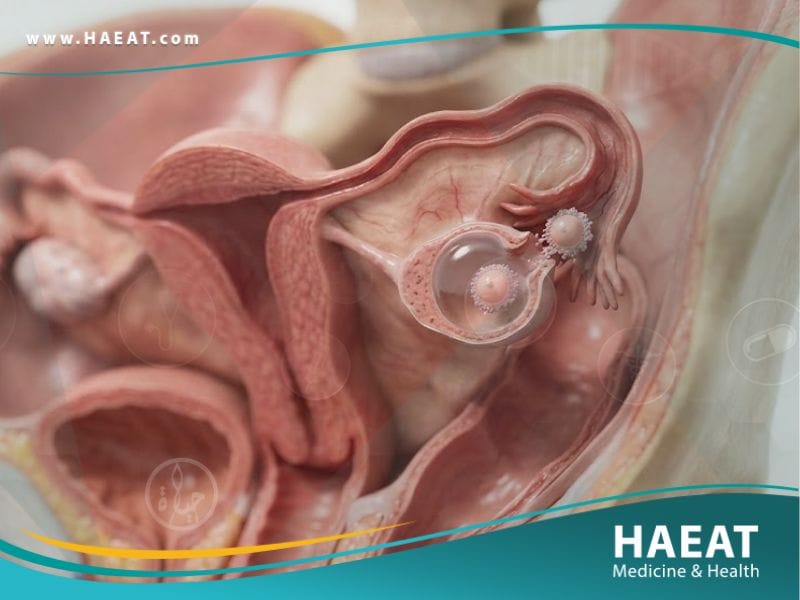 الم التبويض