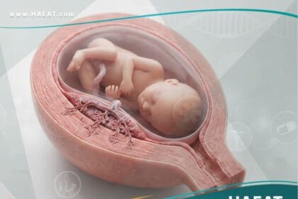 المشيمة الملتصقة