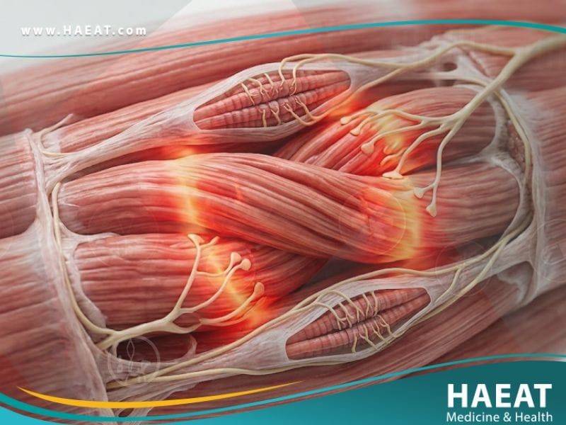 المعص العضلي