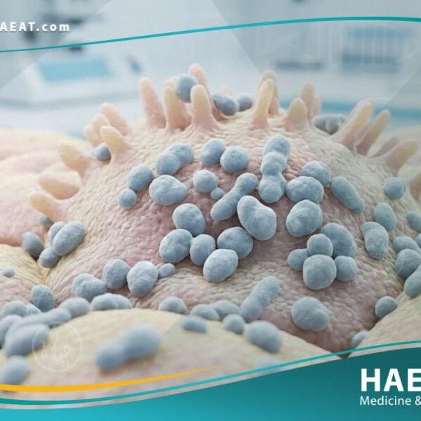 _الميورة الحالة لليوريا