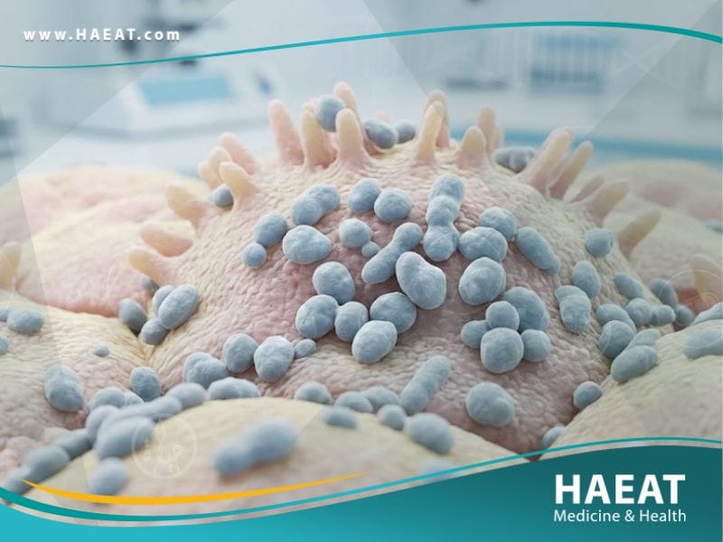 _الميورة الحالة لليوريا