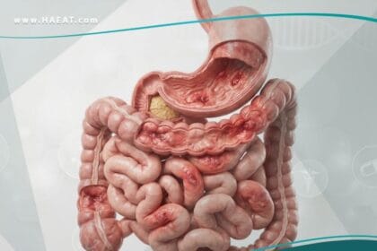 امراض الجهاز الهضمي