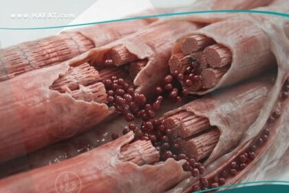 _انحلال الربيدات