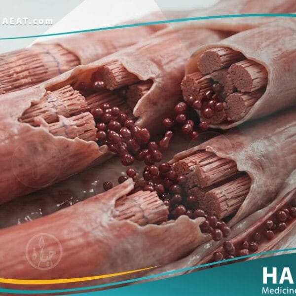 _انحلال الربيدات