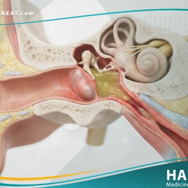 انسداد النفير