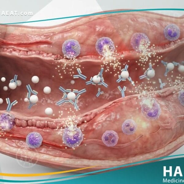 _حساسية الحليب