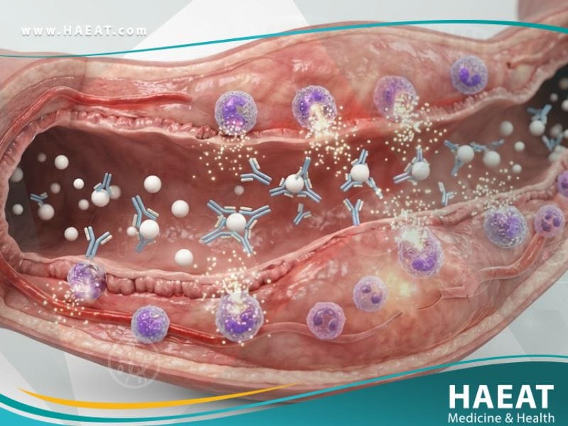 _حساسية الحليب