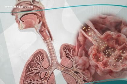 _حمى دخان الفلزات