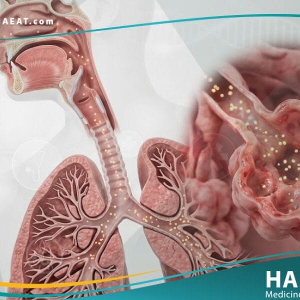 _حمى دخان الفلزات