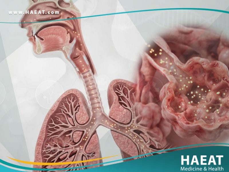 _حمى دخان الفلزات