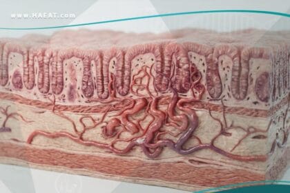 خلل التنسج الوعائي