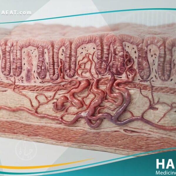 خلل التنسج الوعائي